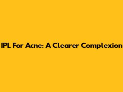 IPL For Acne: A Clearer Complexion