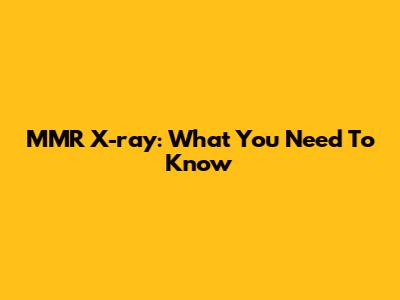 MMR X-ray: What You Need To Know