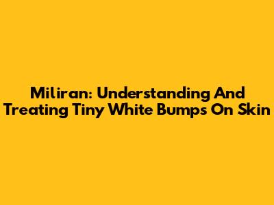 Miliran: Understanding And Treating Tiny White Bumps On Skin